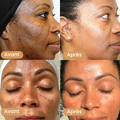 Savon Éclat Naturel - Anti-Taches & Teint Unifié