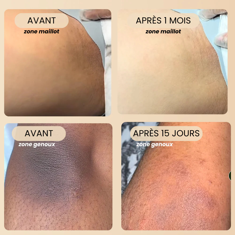 Savon Éclat Naturel - Anti-Taches & Teint Unifié