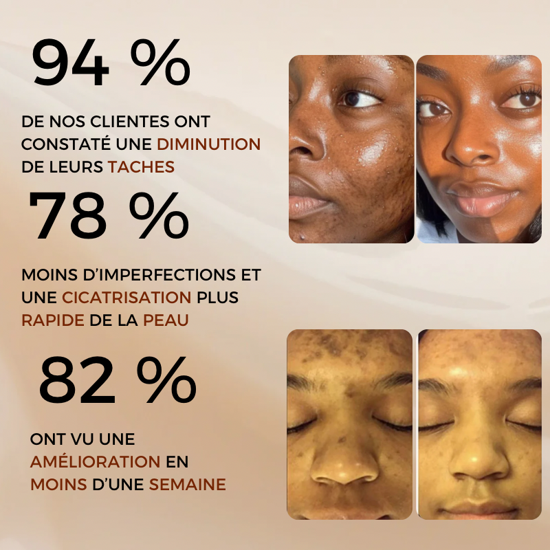 Savon Éclat Naturel - Anti-Taches & Teint Unifié