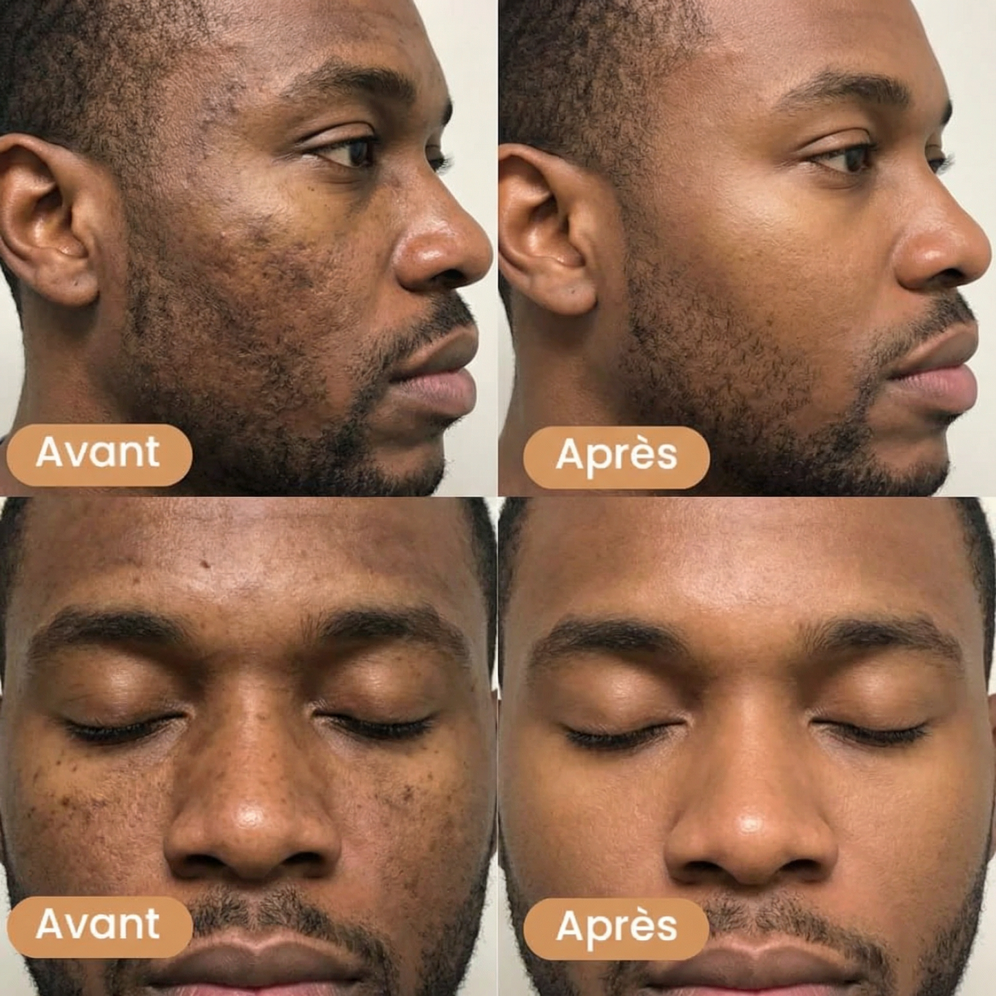 Savon Éclat au Curcuma — Teint Unifié & Peau Lumineuse