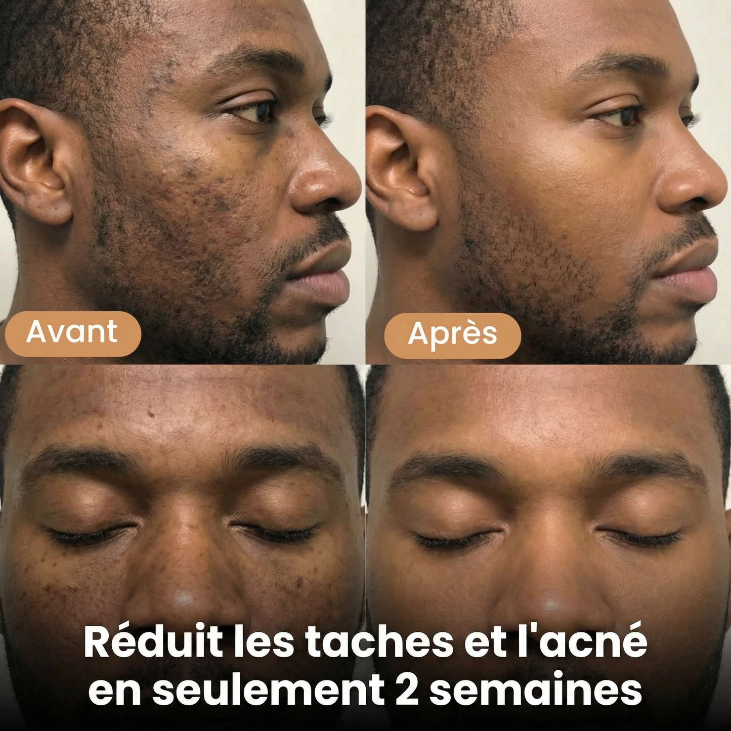 Savon Éclat au Curcuma — Réduit les taches et l'acné en seulement 2 semaines